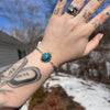 Kingman Turquoise Starburst Cuff- Mike Smith